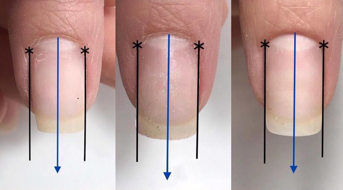Как сделать квадратную форму ногтей дома